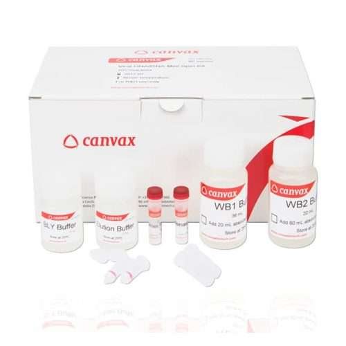 viral dna rna purification kit, viral rna extraction kit