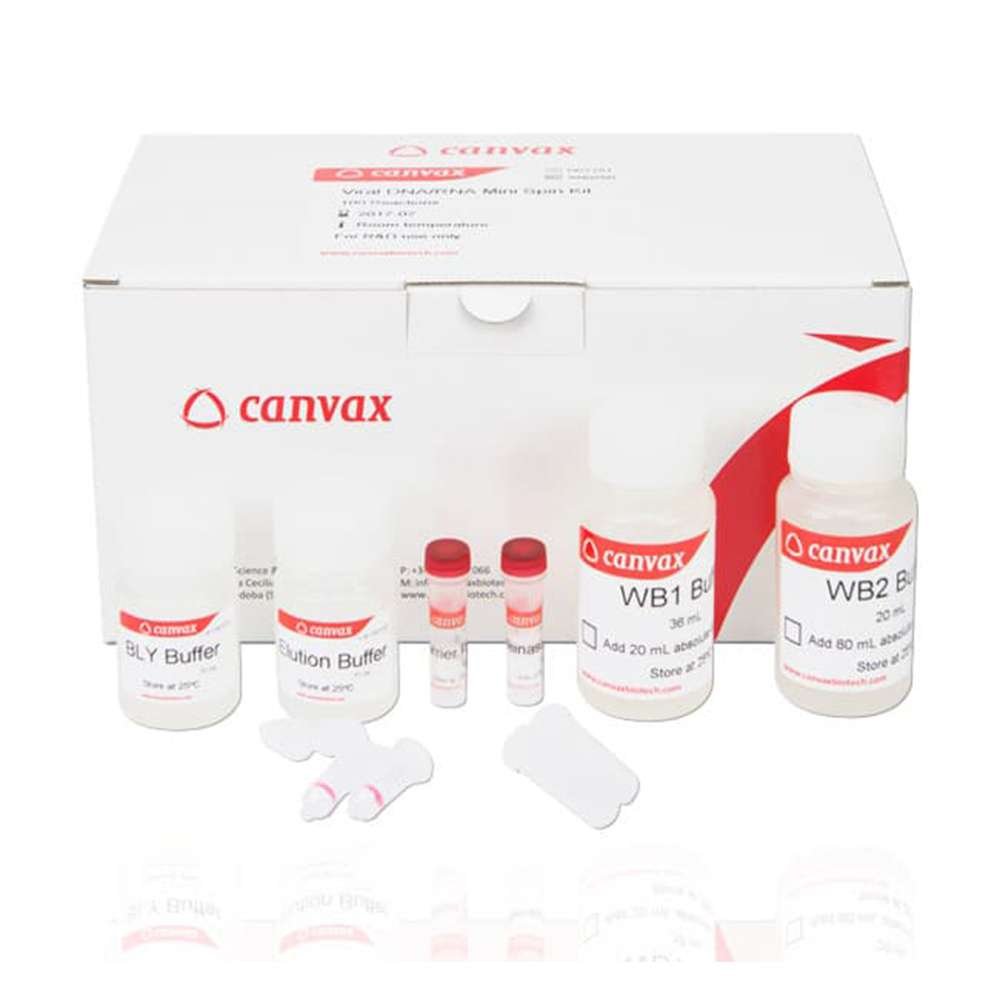 viral dna rna purification kit, viral rna extraction kit